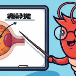 網膜剥離の仕組み